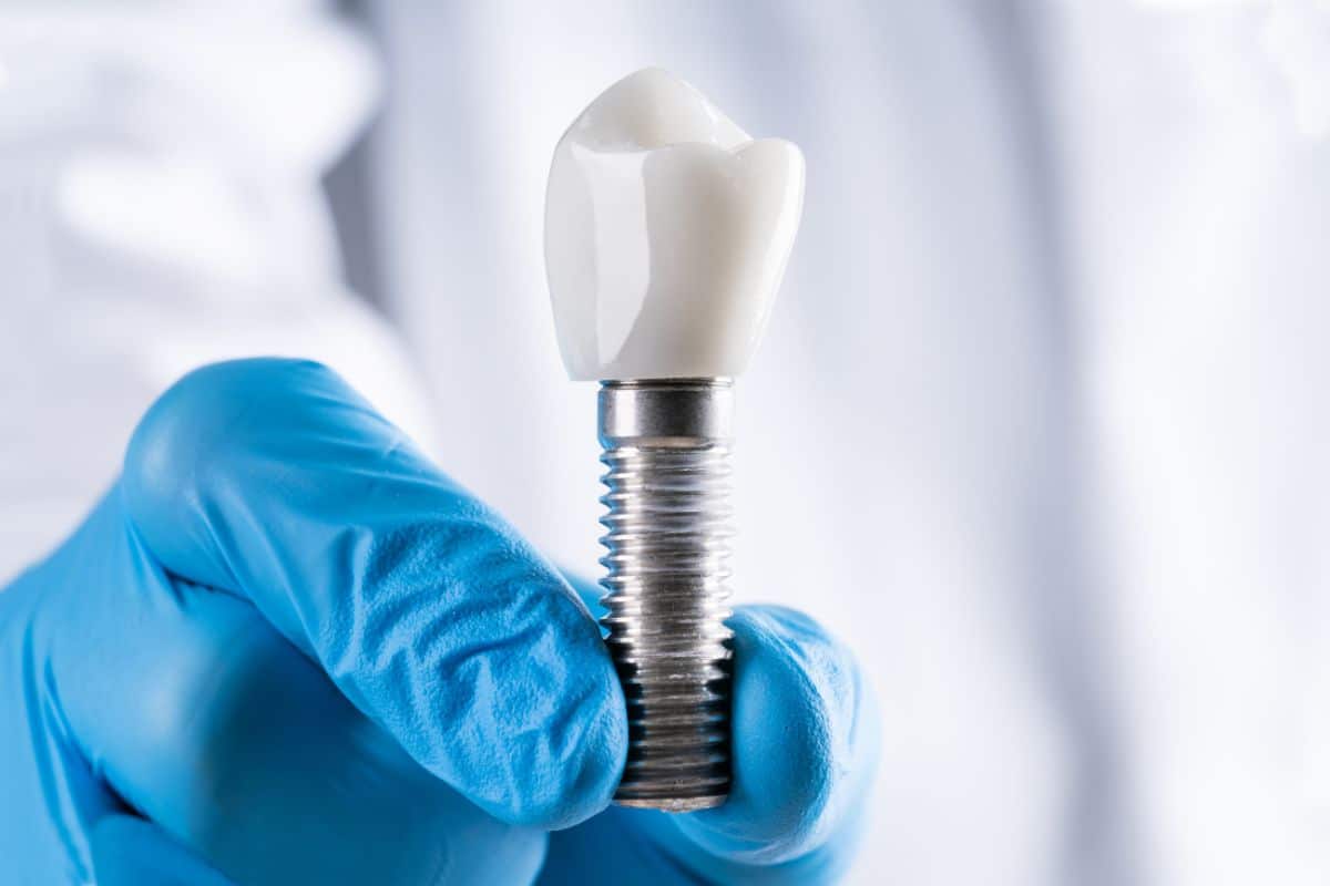 Loose Dental Implant