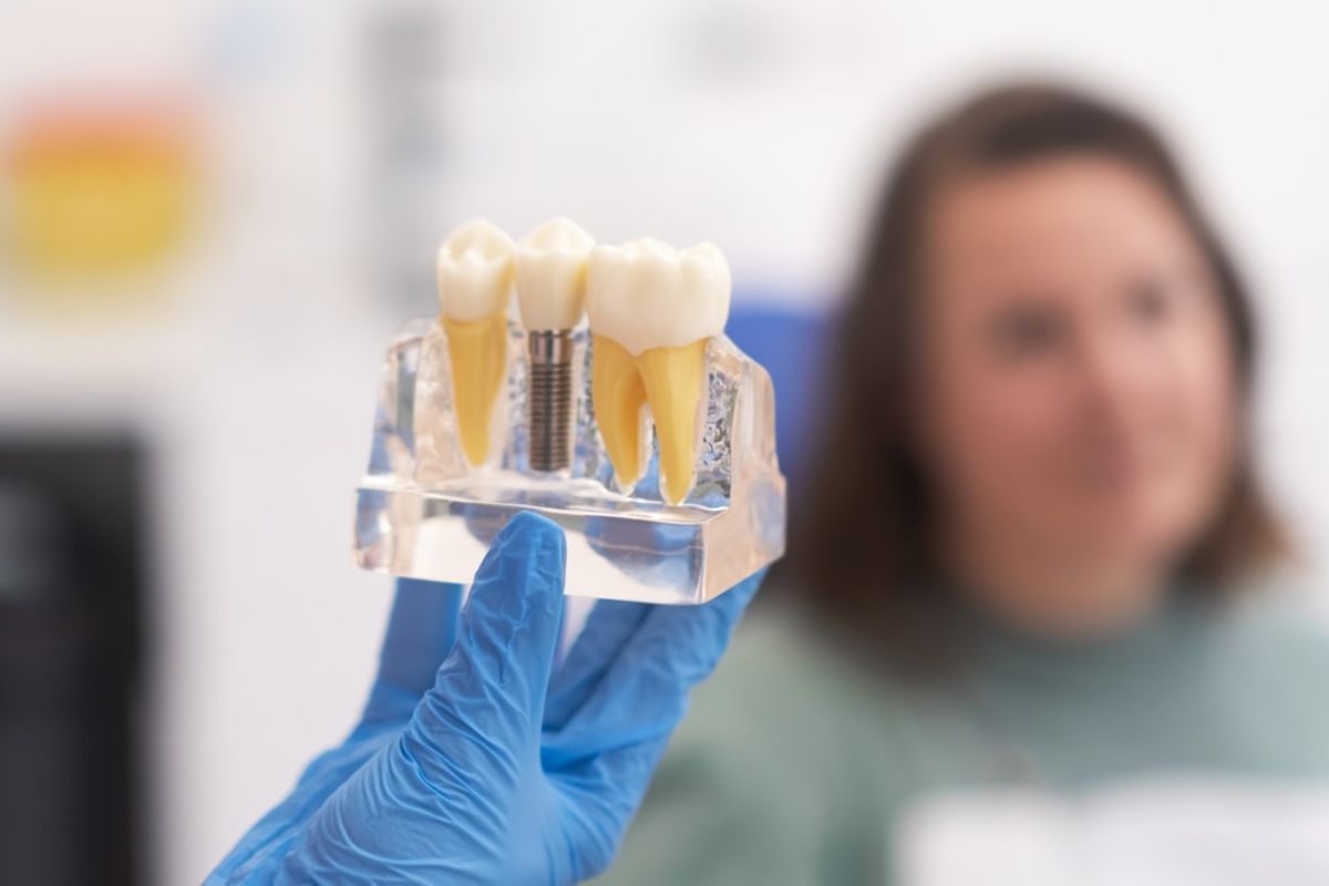 Increase The Longevity Of Your Dental Implants