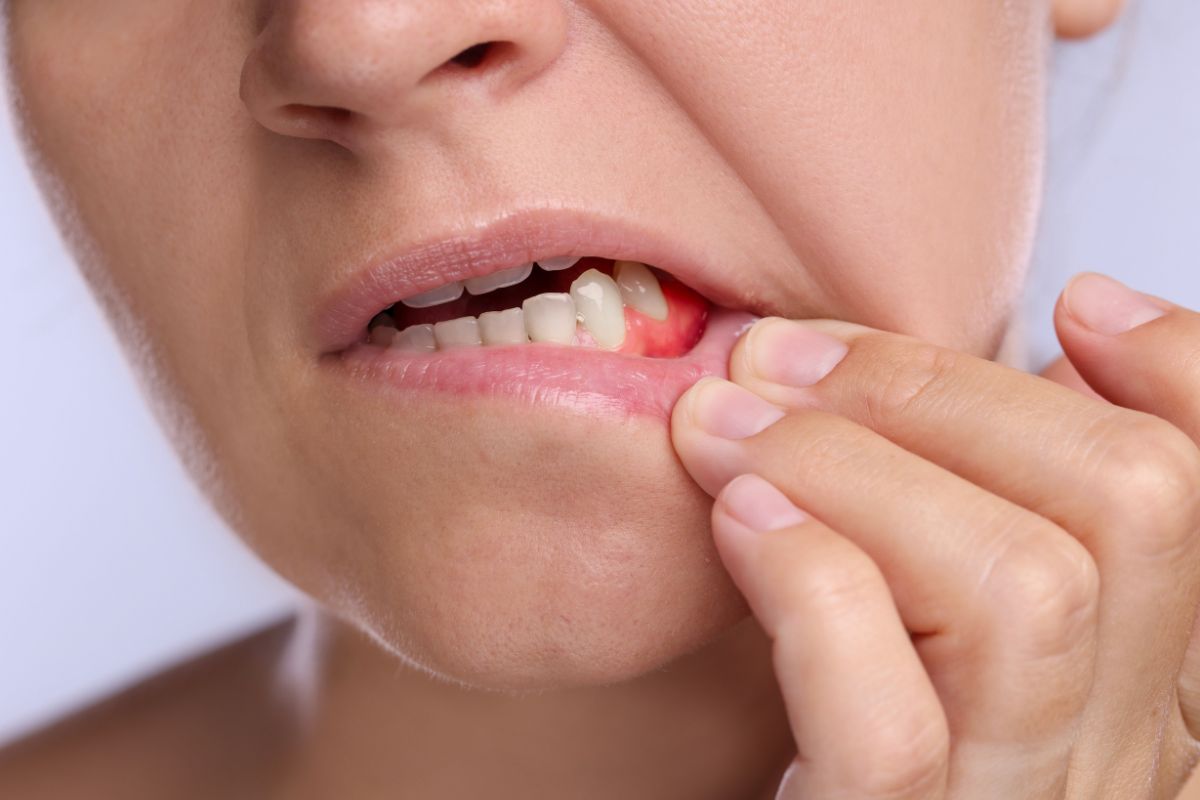 Can Gum Disease Kill You